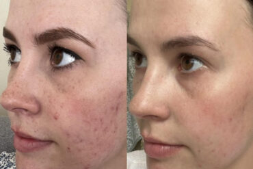 Why Patients Trust Eternia Medspa for Their Aesthetic Treatments
