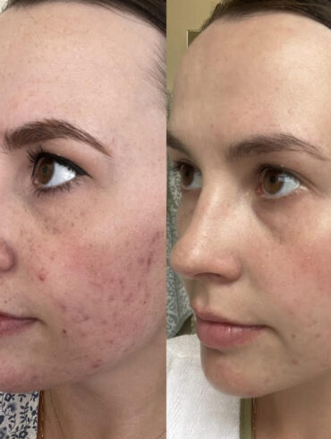 Why Patients Trust Eternia Medspa for Their Aesthetic Treatments