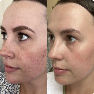 Why Patients Trust Eternia Medspa for Their Aesthetic Treatments