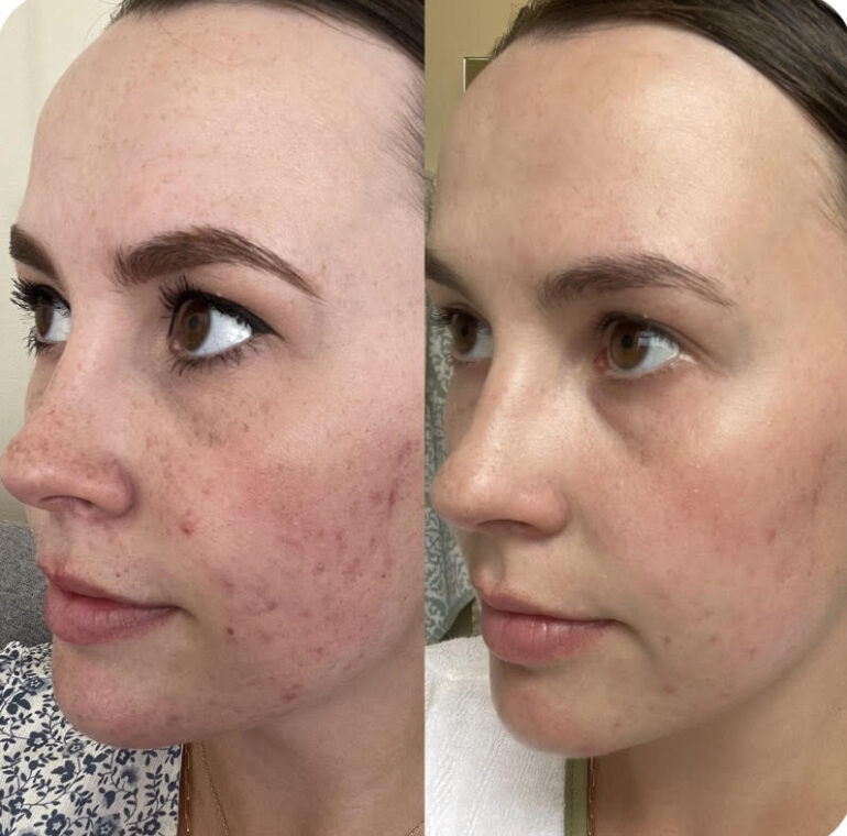 Why Patients Trust Eternia Medspa for Their Aesthetic Treatments