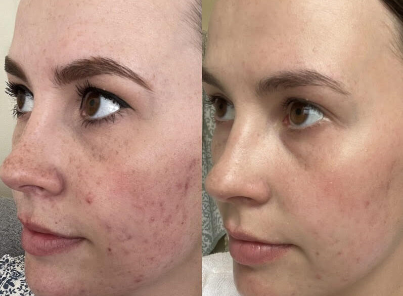Why Patients Trust Eternia Medspa for Their Aesthetic Treatments