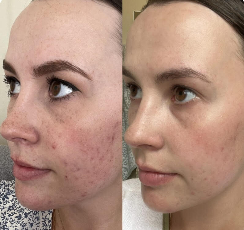 Why Patients Trust Eternia Medspa for Their Aesthetic Treatments